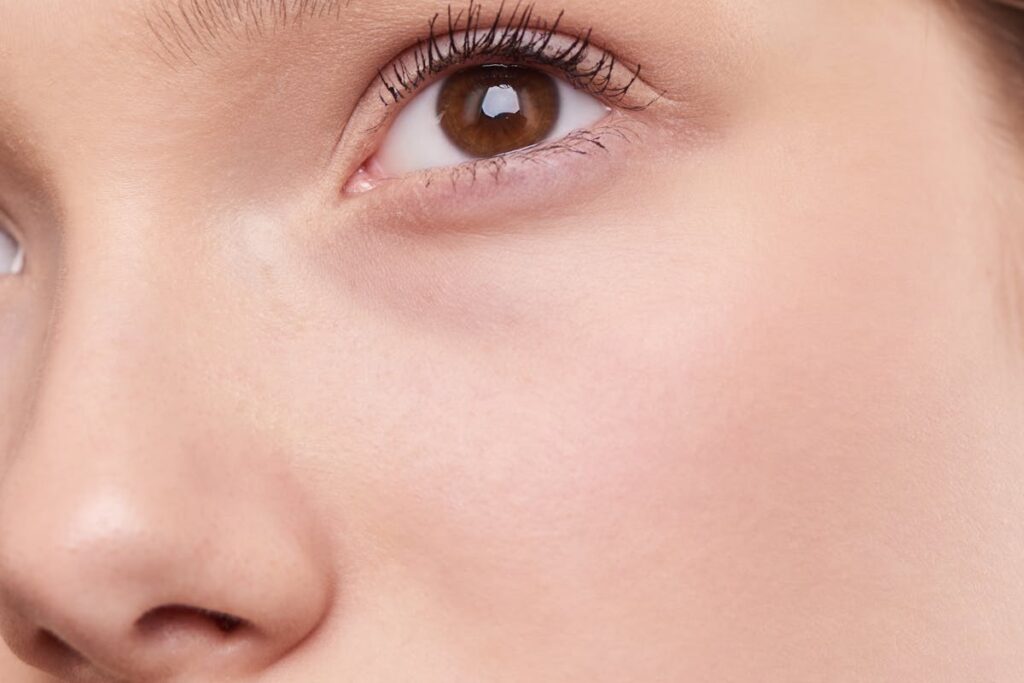 Before and After Anua Azelaic Acid Serum